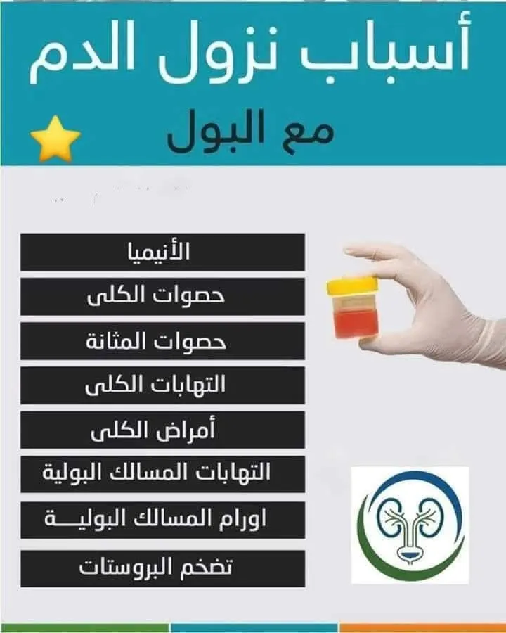 فحص تحليل البول الكامل